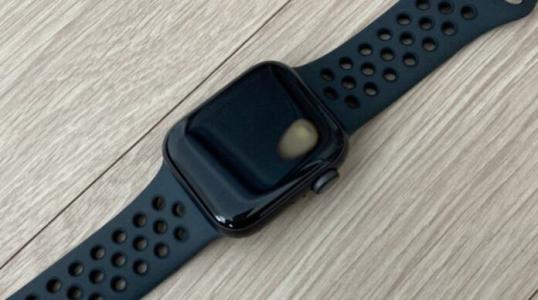 Apple Watch SE làm bỏng tay người đeo