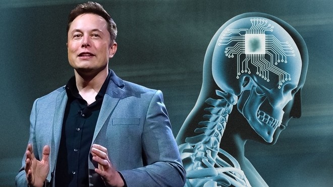 Neuralink, Chip não, Elon Musk, Giao diện não - máy tính, Thần giao cách cảm, AI